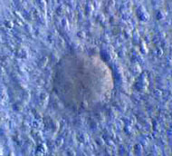 Die Eizelle mit ihrem Kranz von Nhrzellen (Cumulus)